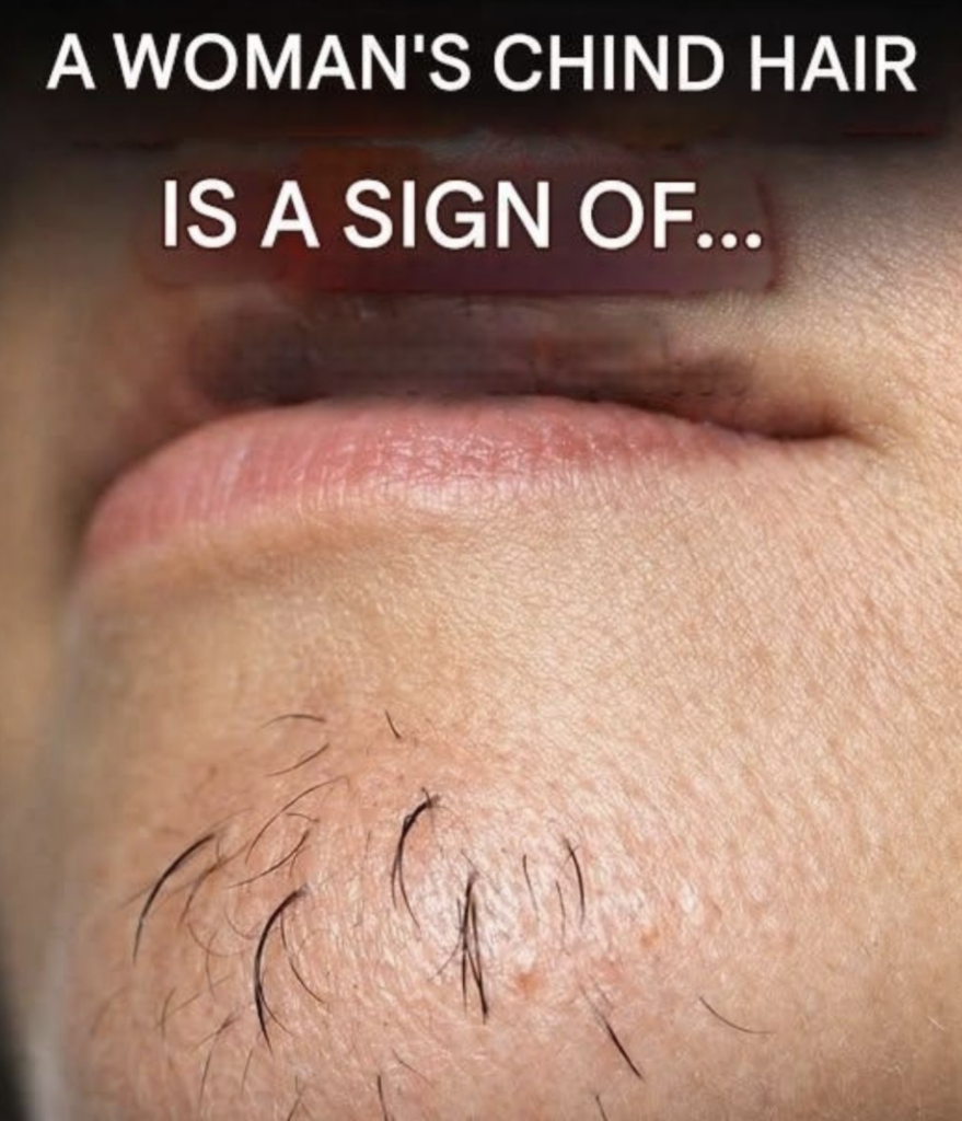 Surprising Truth About Chin Whiskers in Women